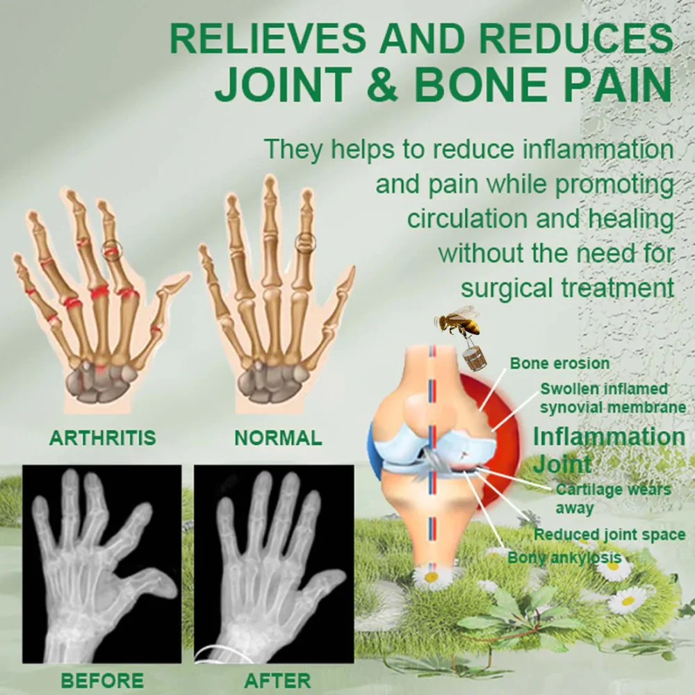 Bee Venom Joint & Bone Therapy Cream - Image 2